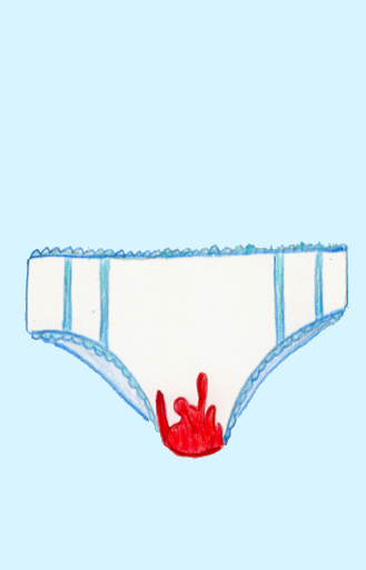 Sangrado menstrual abundante o hipermenorrea
