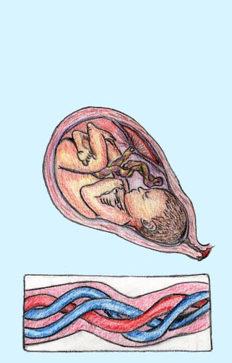 DOPPLER EN OBSTETRICIA