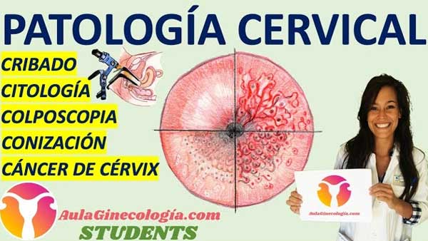 Patología cervical Aula Ginecología Students