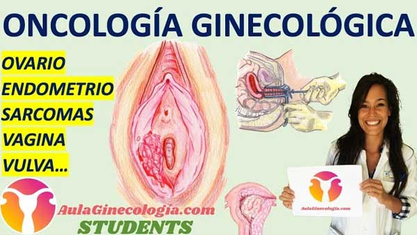 Oncología ginecológica Aula Ginecología Students